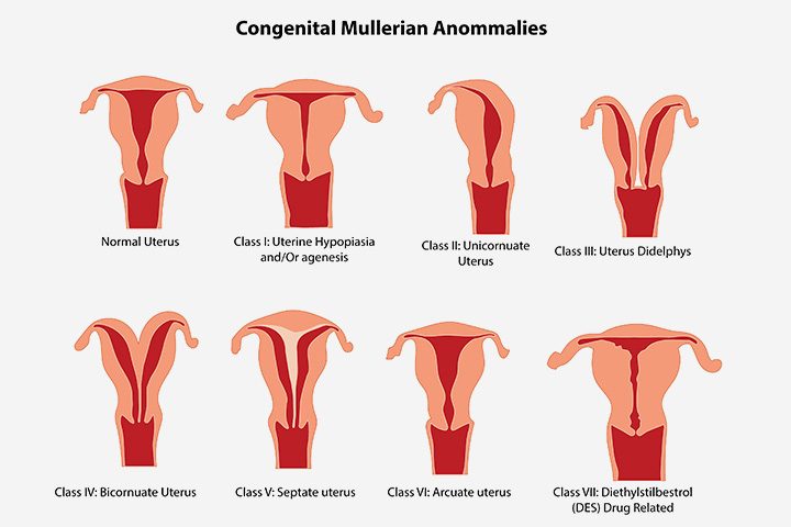 What Are The Causes Of Congenital Abnormalities